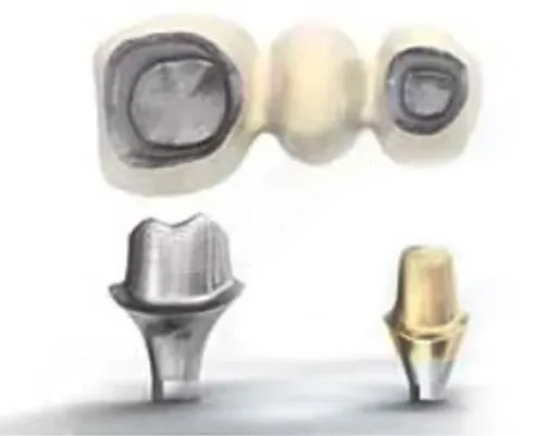 Stock abutments, made to standard sizes