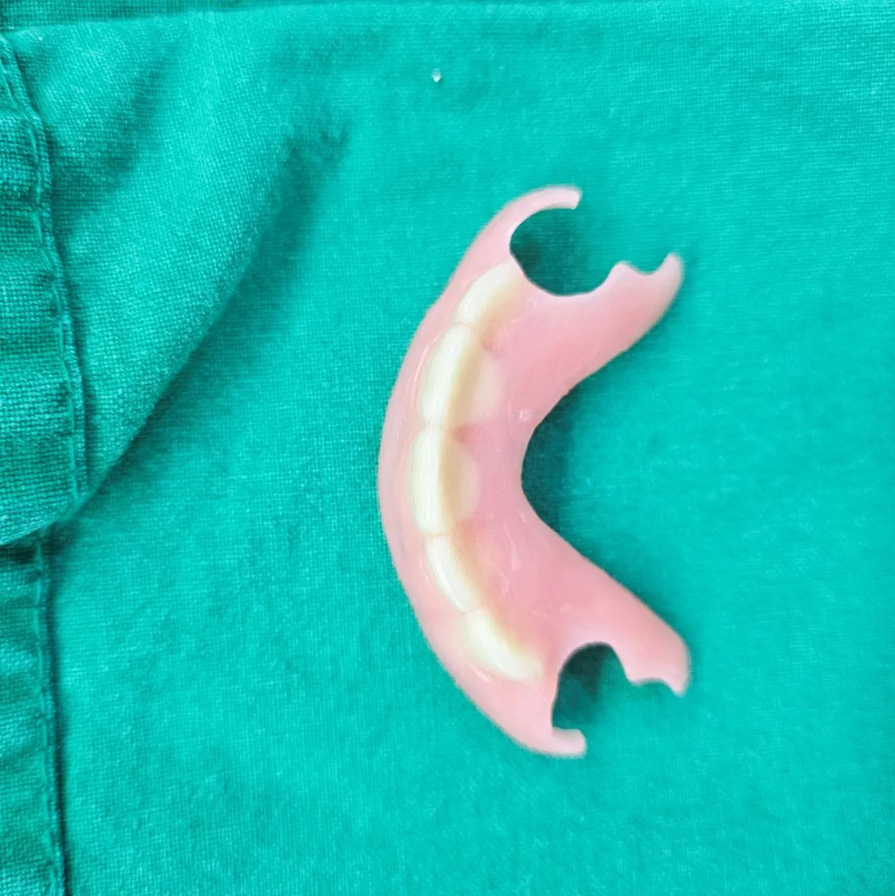 A resin and wire flipper for the upper arch