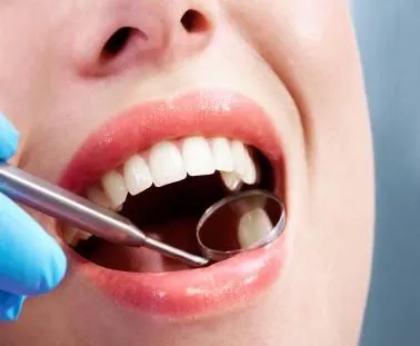 Consultation and examination before veneers