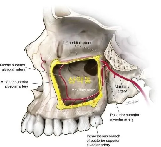 The maxillary sinus and the arteries around it