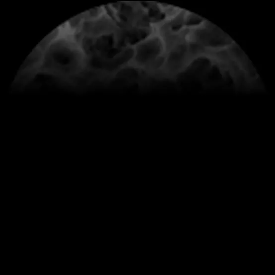 Scanning electron micrograph of an S.L.A. treated implant surface