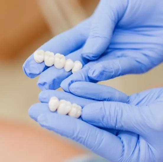Finished ceramic veneers held in the hand